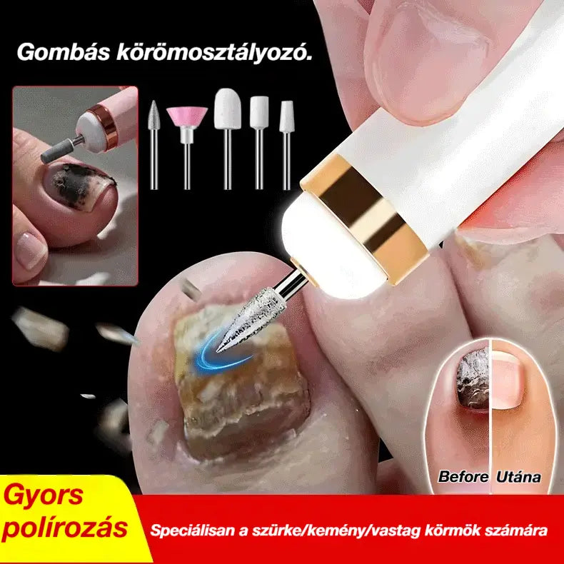 🦶🦶 Elektromos körömreszelő gombagombára, egy kis elektromos körömreszelő.