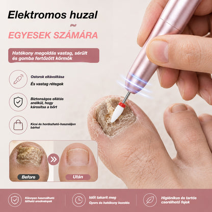 💅👍 Elektromos körömreszelő az onychomycosis kezelésére