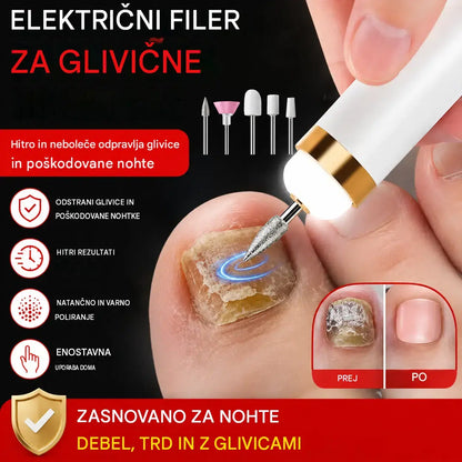 🦶🦶 Električna pilica za nohte za glivice na nohtih na nogah, majhna električna pilica za nohte.